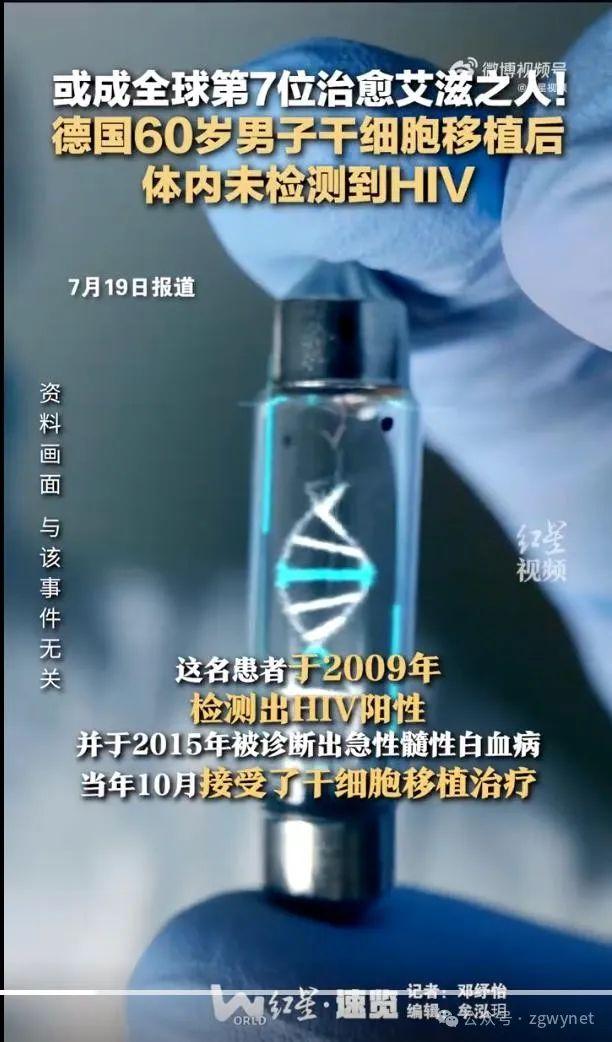 艾滋病最新治疗进展及其观点深度论述